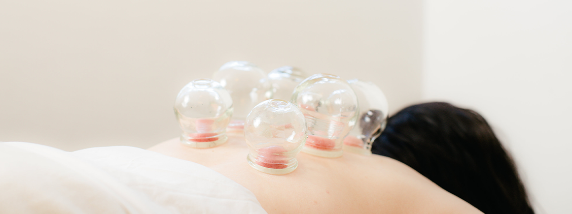 Cupping, Holistic Treatment.